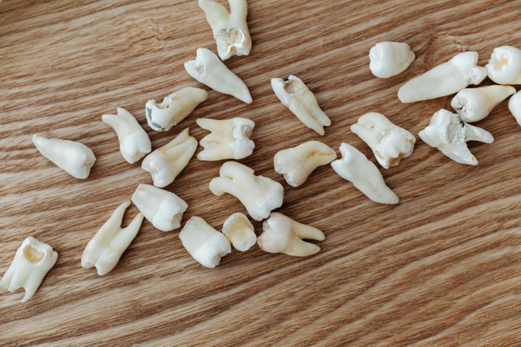 loose teeth on a wooden background
